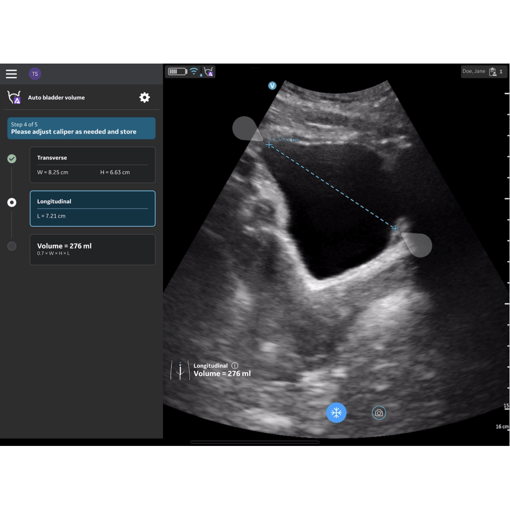 Vscan Air™ CL Auto Bladder Volume